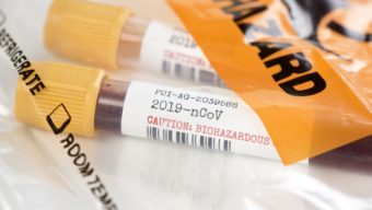 Coronavirus : 161 cas confirmés en Pays de la Loire