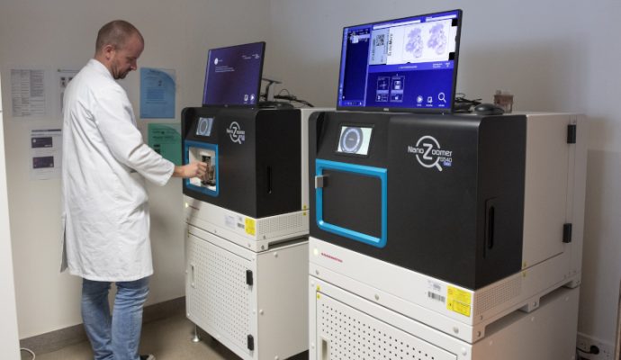 Le CHU d&rsquo;Angers se dote de nouveaux équipements pour améliorer le diagnostic des cancers